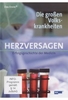 Die großen Volkskrankheiten - Herzversagen: Erfolgsgeschichte der Medizin