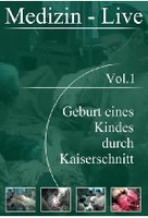 Geburt eines Kindes durch Kaiserschnitt