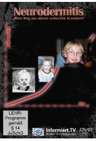 Neurodermitis - Mein Weg aus dieser schweren Krankheit