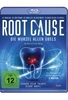 Root Cause