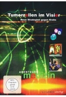 Tumorzellen im Visier - Neue Strategien gegen Krebs