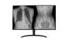 LG Diagnostik Monitor 32HL512D-B LED-Display 80, 01 (31, 5")